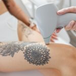 Female cosmetologist performing laser hair removal procedure